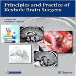 خرید و دانلود Principles and Practice of Keyhole Brain Surgery