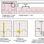 خرید و دانلود جزوه تفسیر ECG برای پرستاران