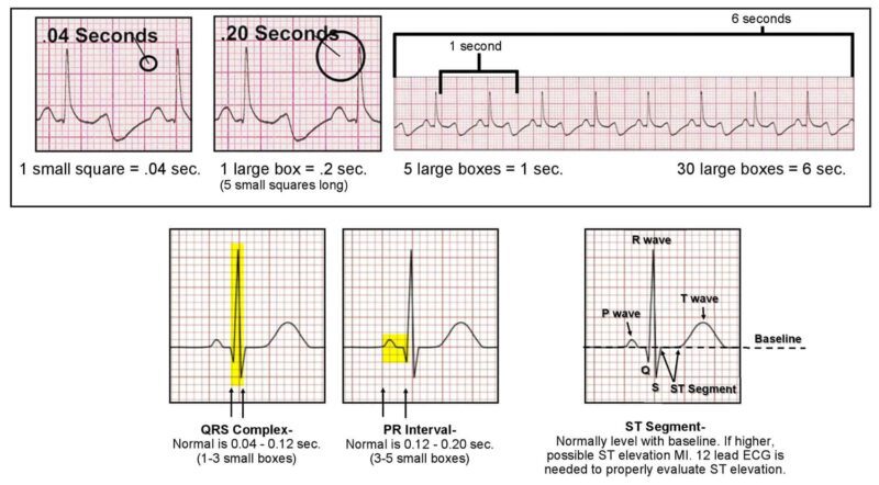 خرید و دانلود جزوه تفسیر ECG برای پرستاران - تصویر 1