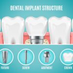 خرید و دانلود جزوه راهنمای انتخاب سایز ایمپلنت