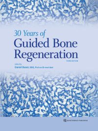 خرید و دانلود نسخه کامل کتاب 30 Years of Guided Bone Regeneration (3rd Edition) –  Pdf