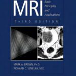 خرید و دانلود نسخه کامل کتاب MRI: basic principles and applications