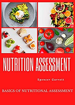 خرید و دانلود نسخه کامل کتاب Nutrition Assessment : Basics of nutritional assessment (FRESH MAN) Kindle Edition –  +  PDF