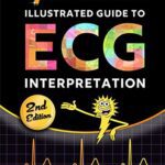 خرید و دانلود نسخه کامل کتاب Sparkson’s Illustrated Guide to ECG Interpretation  (2nd Edition) –  PDF