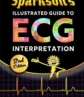 خرید و دانلود نسخه کامل کتاب Sparkson’s Illustrated Guide to ECG Interpretation (2nd Edition) – PDF