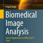 خرید و دانلود نسخه کامل کتاب Biomedical Image Analysis: Special Applications in MRIs and CT scans