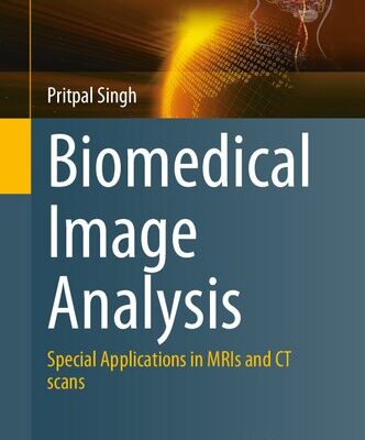 خرید و دانلود نسخه کامل کتاب Biomedical Image Analysis: Special Applications in MRIs and CT scans