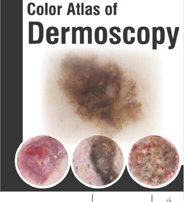 خرید و دانلود نسخه کامل کتاب Colour Atlas of Dermoscopy