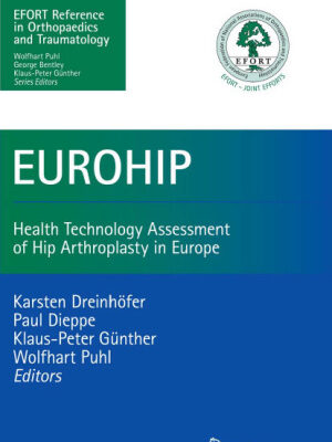 خرید و دانلود نسخه کامل کتاب EUROHIP: Health Technology Assessment of Hip Arthroplasty in Europe