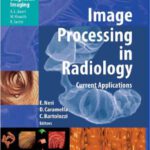 خرید و دانلود نسخه کامل کتاب Image Processing in Radiology Current Applications