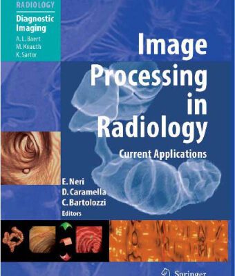 خرید و دانلود نسخه کامل کتاب Image Processing in Radiology Current Applications