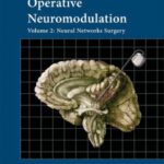 خرید و دانلود نسخه کامل کتاب Operative Neuromodulation Volume 2 Neural Networks Surgery