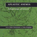خرید و دانلود نسخه کامل کتاب Aplastic Anemia: Pathophysiology and Treatment