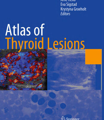 خرید و دانلود نسخه کامل کتاب Atlas of thyroid lesions