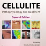 خرید و دانلود نسخه کامل کتاب Cellulite: Pathophysiology and Treatment, 2nd Edition (Basic and Clinical Dermatology)