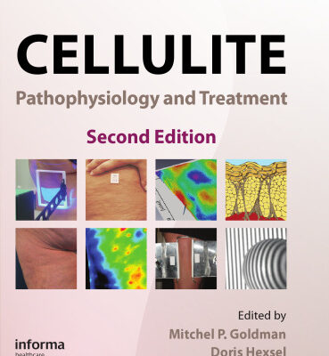 خرید و دانلود نسخه کامل کتاب Cellulite: Pathophysiology and Treatment, 2nd Edition (Basic and Clinical Dermatology)