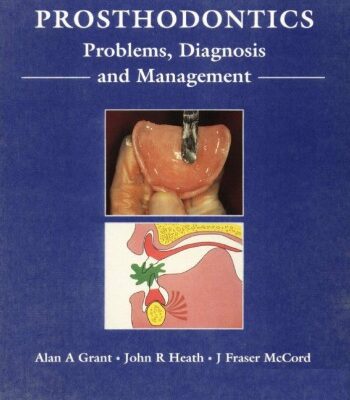 خرید و دانلود نسخه کامل کتاب Complete Prosthodontics: Diagnosis and Management