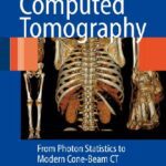 خرید و دانلود نسخه کامل کتاب Computer Tomography – From Photon Statistics to Modern Cone-Beam CT