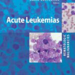 خرید و دانلود نسخه کامل کتاب Hematologic Malignancies: Acute Leukemias