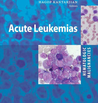 خرید و دانلود نسخه کامل کتاب Hematologic Malignancies: Acute Leukemias