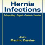 خرید و دانلود نسخه کامل کتاب Hernia Infections: Pathophysiology – Diagnosis – Treatment – Prevention