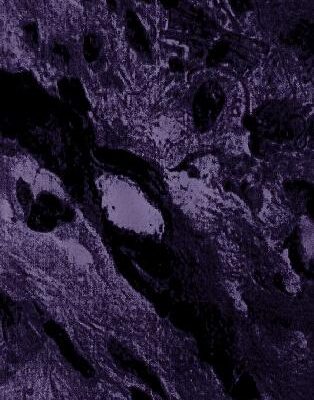 خرید و دانلود نسخه کامل کتاب Metastasis Research Protocols. Analysis of Cell Behavior In Vitro and In Vivo