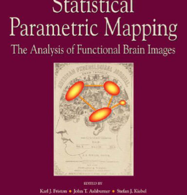 خرید و دانلود نسخه کامل کتاب Statistical parametric mapping: the analysis of funtional brain images
