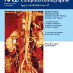 خرید و دانلود نسخه کامل کتاب Ganzkörper-Computertomographie Spiral- und Multislice-CT - Orginal Pdf