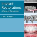 خرید و دانلود نسخه کامل کتاب Implant Restorations: A Step-by-Step Guide (3rd Edition) - Orginal Pdf