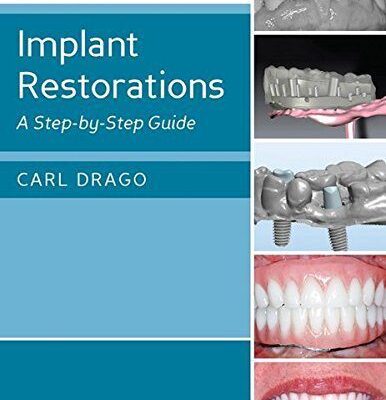 خرید و دانلود نسخه کامل کتاب Implant Restorations: A Step-by-Step Guide (3rd Edition) - Orginal Pdf