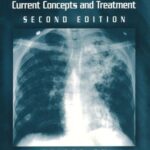 خرید و دانلود نسخه کامل کتاب Tuberculosis: Current Concepts and Treatment (2nd Edition) - Orginal Pdf
