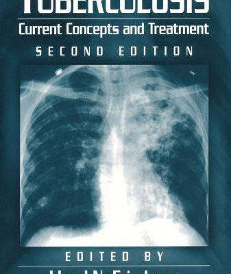 خرید و دانلود نسخه کامل کتاب Tuberculosis: Current Concepts and Treatment (2nd Edition) - Orginal Pdf