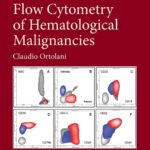 خرید و دانلود نسخه کامل کتاب Flow Cytometry of Hematological Malignancies (2nd Edition) - + Pdf