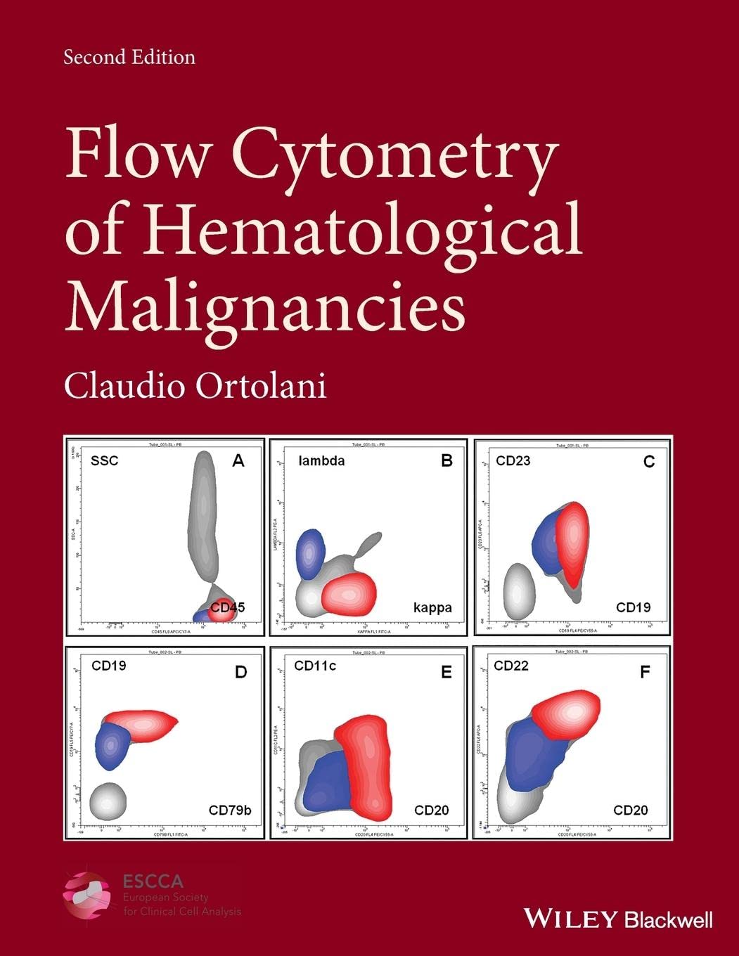 61EySTU8gUL._SL1360_ خرید و دانلود نسخه کامل کتاب Flow Cytometry of Hematological Malignancies (2nd Edition) - + Pdf