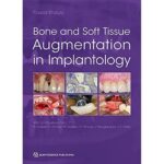 خرید و دانلود نسخه کامل کتاب Bone and Soft Tissue Augmentation in Implantology - + Pdf
