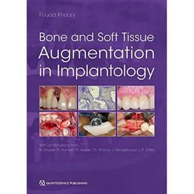 خرید و دانلود نسخه کامل کتاب Bone and Soft Tissue Augmentation in Implantology - + Pdf