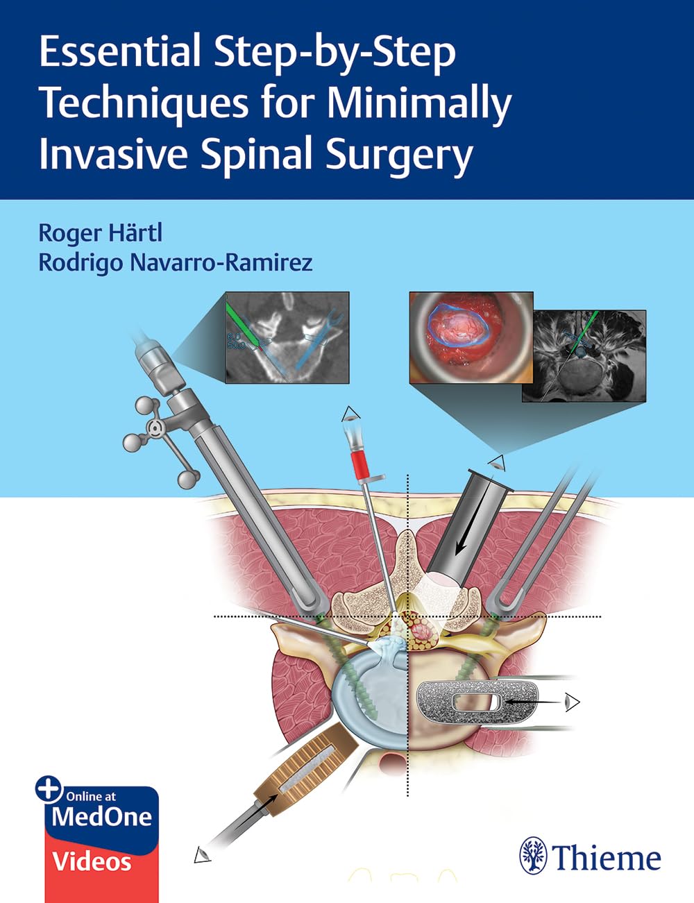 61amkoDeMsL._SL1301_ خرید و دانلود نسخه کامل کتاب Essential Step-by-Step Techniques for Minimally Invasive Spinal Surgery - Orginal Pdf
