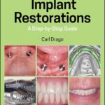 خرید و دانلود نسخه کامل کتاب Implant Restorations: A Step-by-Step Guide (4th Edition) - Orginal Pdf