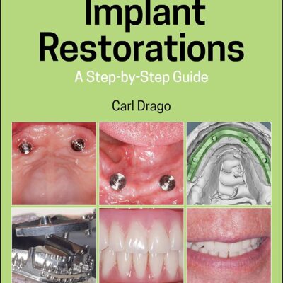 خرید و دانلود نسخه کامل کتاب Implant Restorations: A Step-by-Step Guide (4th Edition) - Orginal Pdf