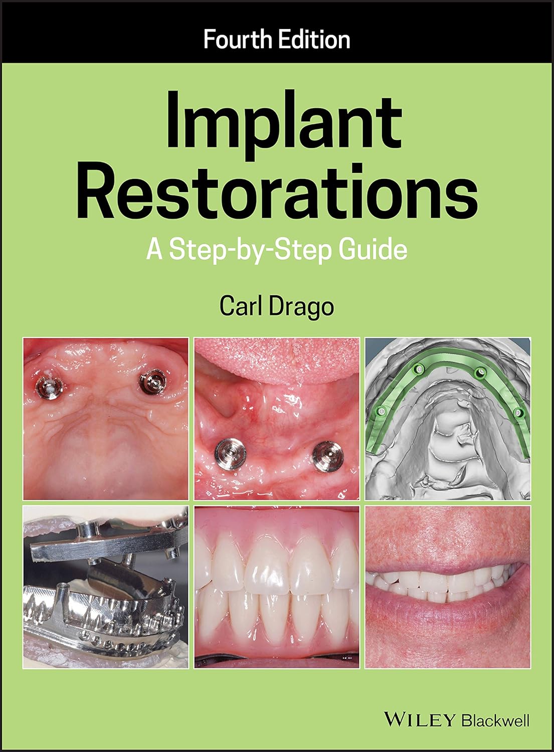 81WwkH66Z6L._SL1500_ خرید و دانلود نسخه کامل کتاب Implant Restorations: A Step-by-Step Guide (4th Edition) - Orginal Pdf