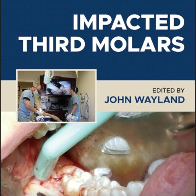 خرید و دانلود نسخه کامل کتاب Impacted Third Molars - Orginal Pdf