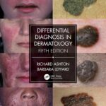 خرید و دانلود نسخه کامل کتاب Differential Diagnosis in Dermatology (5th Edition) - Orginal Pdf