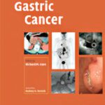 خرید و دانلود نسخه کامل کتاب 100 Q&A About Gastric Cancer (100 Questions & Answers about . . .) (100 Questions and Answers)