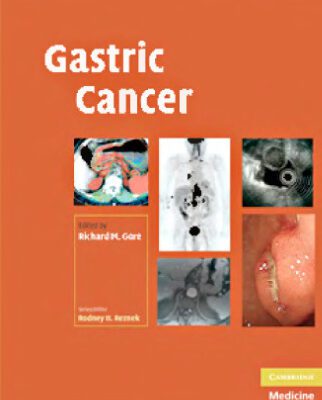 خرید و دانلود نسخه کامل کتاب 100 Q&A About Gastric Cancer (100 Questions & Answers about . . .) (100 Questions and Answers)