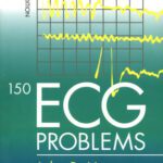 خرید و دانلود نسخه کامل کتاب 150 ECG Problems