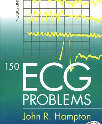 خرید و دانلود نسخه کامل کتاب 150 ECG Problems
