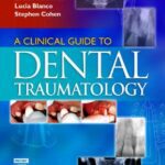 خرید و دانلود نسخه کامل کتاب A Clinical Guide to Dental Traumatology