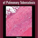 خرید و دانلود نسخه کامل کتاب A Color Atlas of Comparative Pathology of Pulmonary Tuberculosis