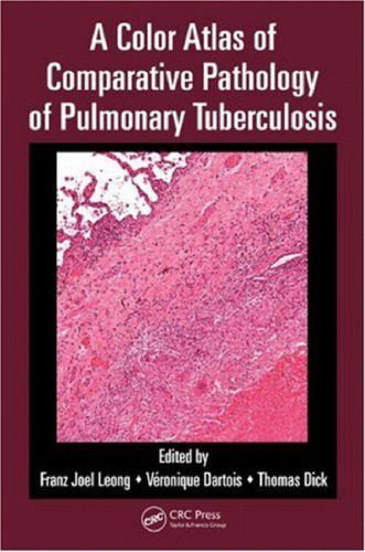 خرید و دانلود نسخه کامل کتاب A Color Atlas of Comparative Pathology of Pulmonary Tuberculosis_68b4dbd6768da.jpeg خرید و دانلود نسخه کامل کتاب A Color Atlas of Comparative Pathology of Pulmonary Tuberculosis