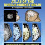 خرید و دانلود نسخه کامل کتاب A Combined MRI and Histology Atlas of the Rhesus Monkey Brain in Stereotaxic Coordinates